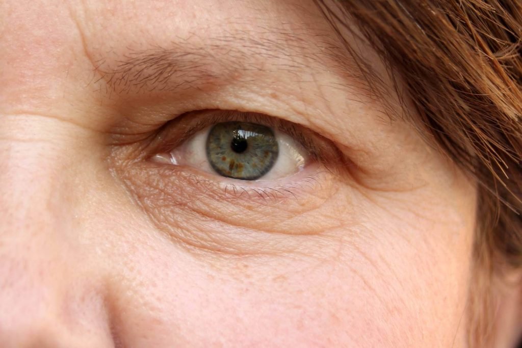 Cómo prevenir y reducir las arrugas y bolsas en los ojos de forma natural