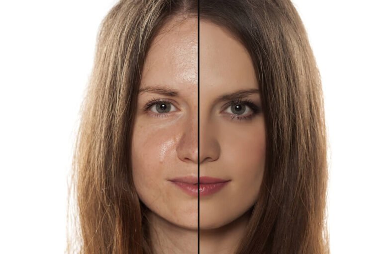 ¿Qué tipo de piel tarda más en envejecer?